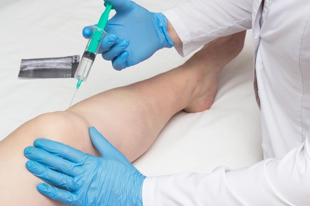 How Stem Cell Injections Work