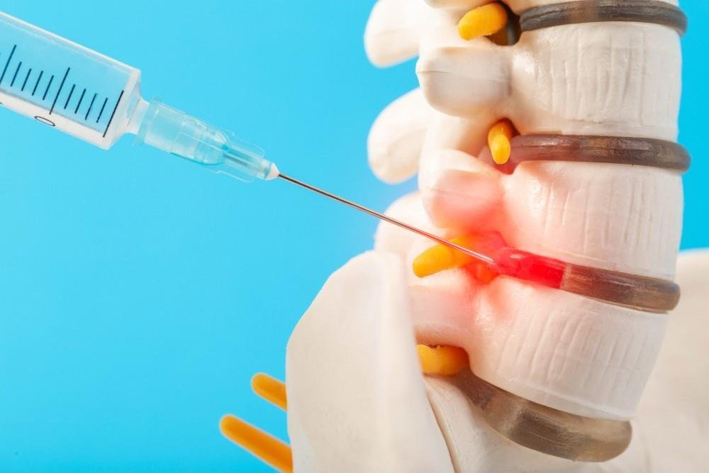 Understanding the Different Types of Nerve Blocks and Their Uses