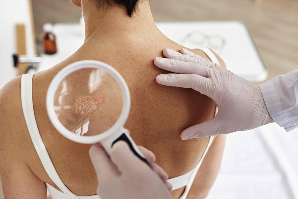 Understanding Skin Cancer Treatment Options