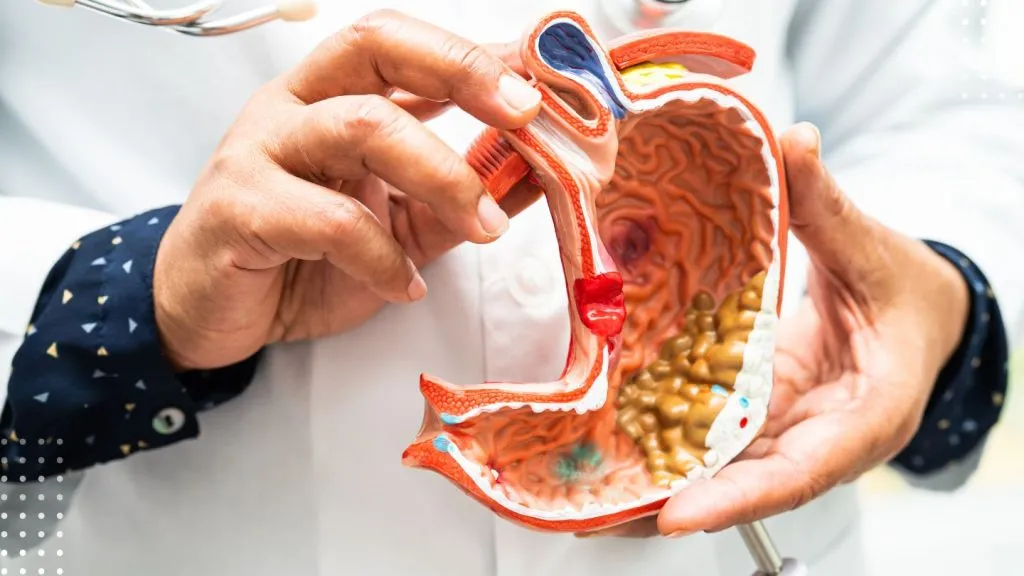 The Role of Sleeve Surgery in Long-term Weight Management