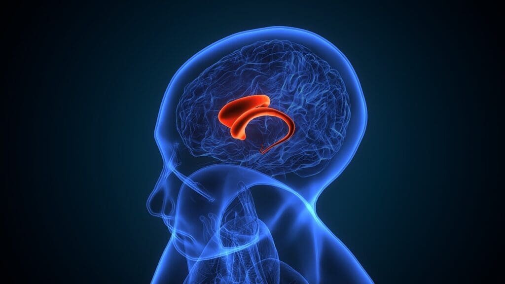 Hydrocephalus and Its Impact on Cognitive Development