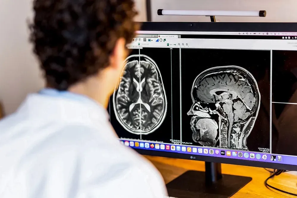 The Connection Between Neurologists and Pain Management