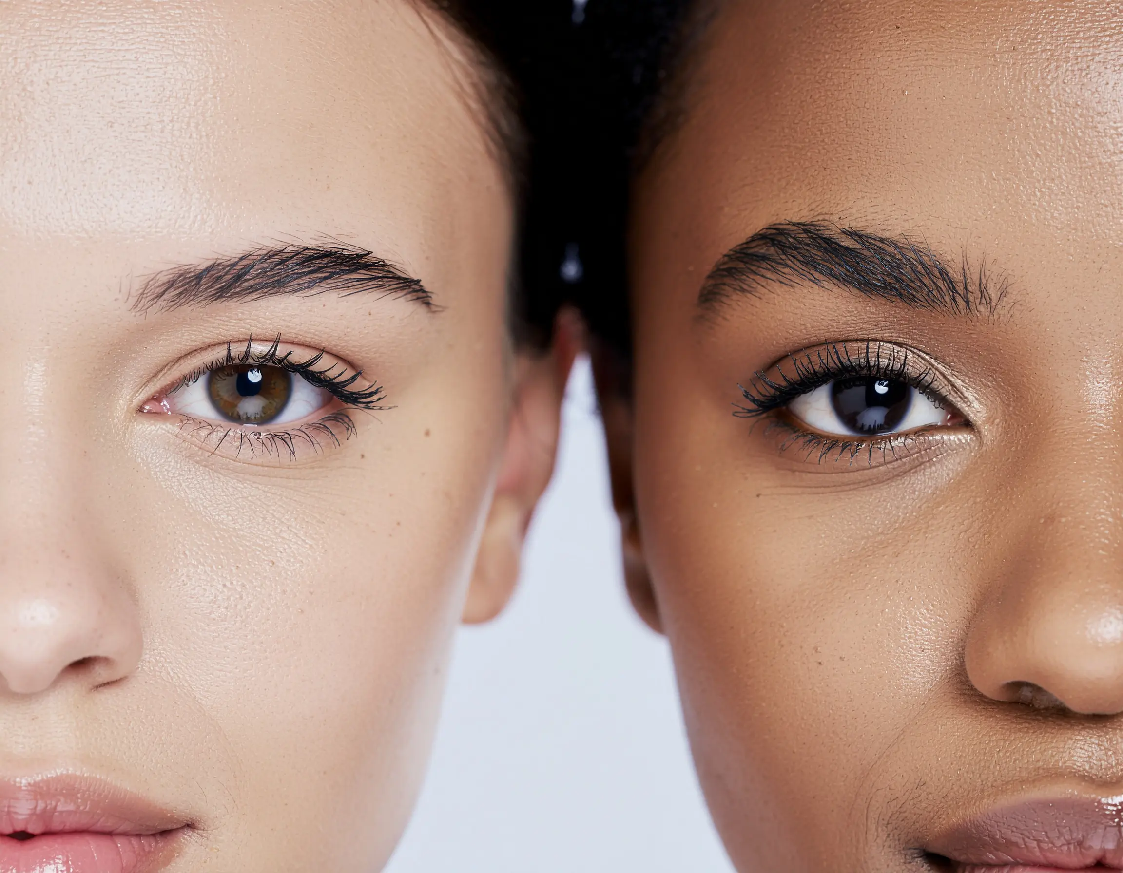 The Role of Blepharoplasty in Restoring a Youthful Look