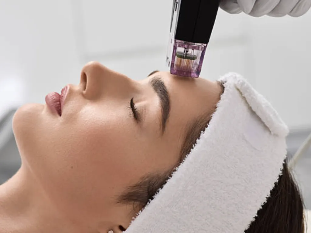 Microneedling Aftercare Tips